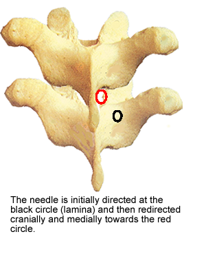 apvertebrae